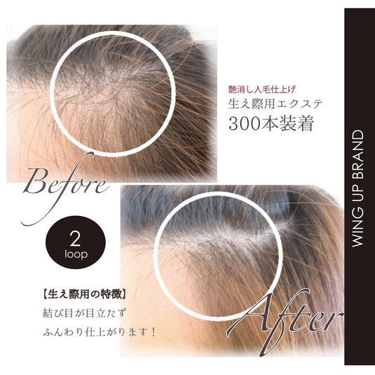 WING UP Hair Volume-Up Extension for Hairline – 2-Strand × 500 Bundles (1,000 Strands)